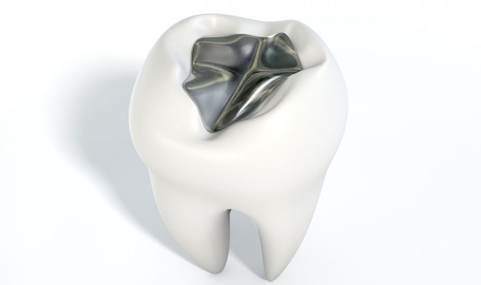 Mercury Fillings | Holistic Dental Treatment | Pure Holistic Dental