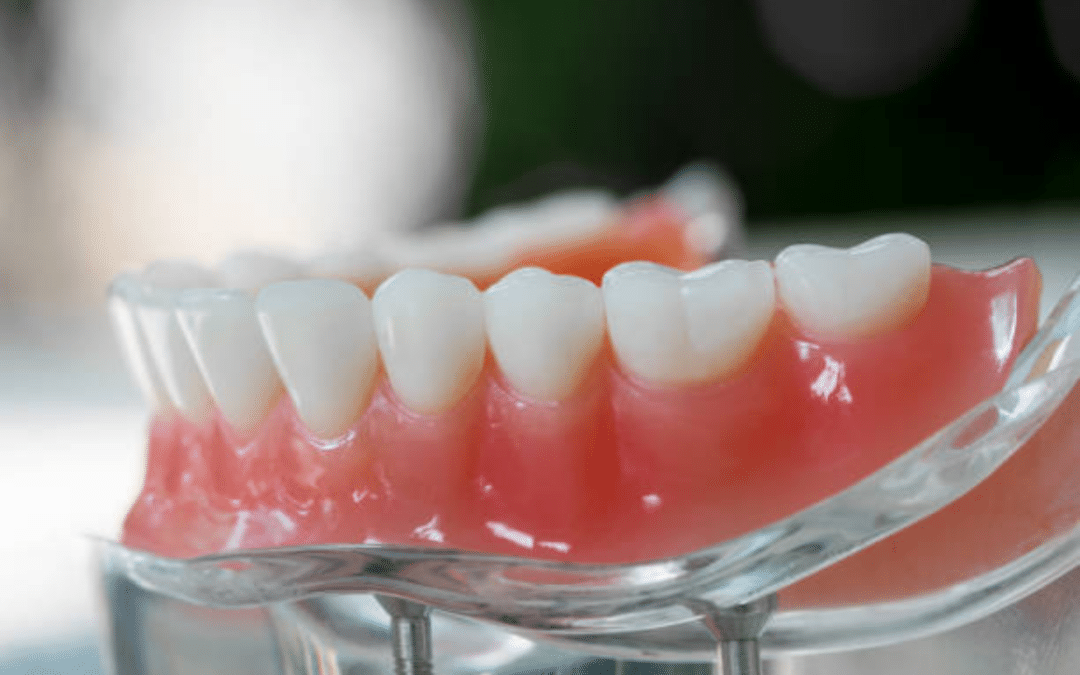 how to care for your zirconia implants
