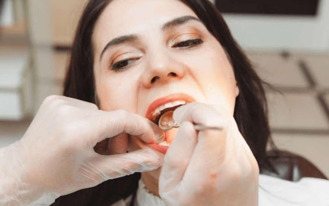 mercury removal impact oral health improvement