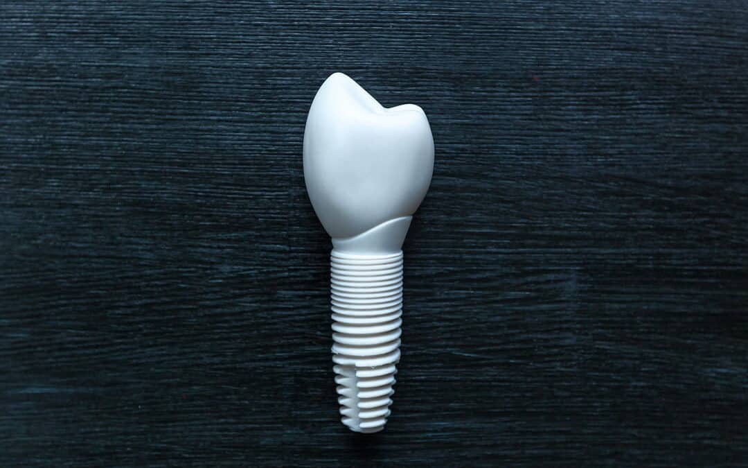 Unveiling Zirconia Implants: What’s Known and What Isn’t?