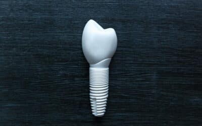 Unveiling Zirconia Implants: What’s Known and What Isn’t?