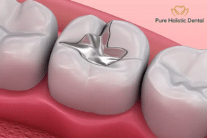 environmental impact of mercury fillings