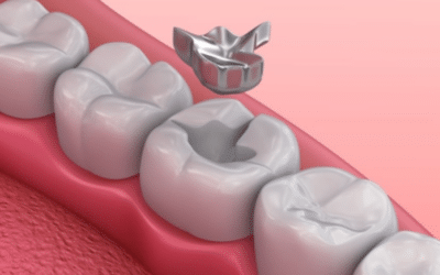 Why Mercury Fillings Are Harmful: Understanding the Risks