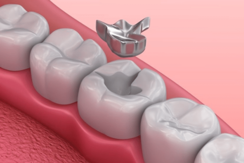 why mercury fillings are harmful