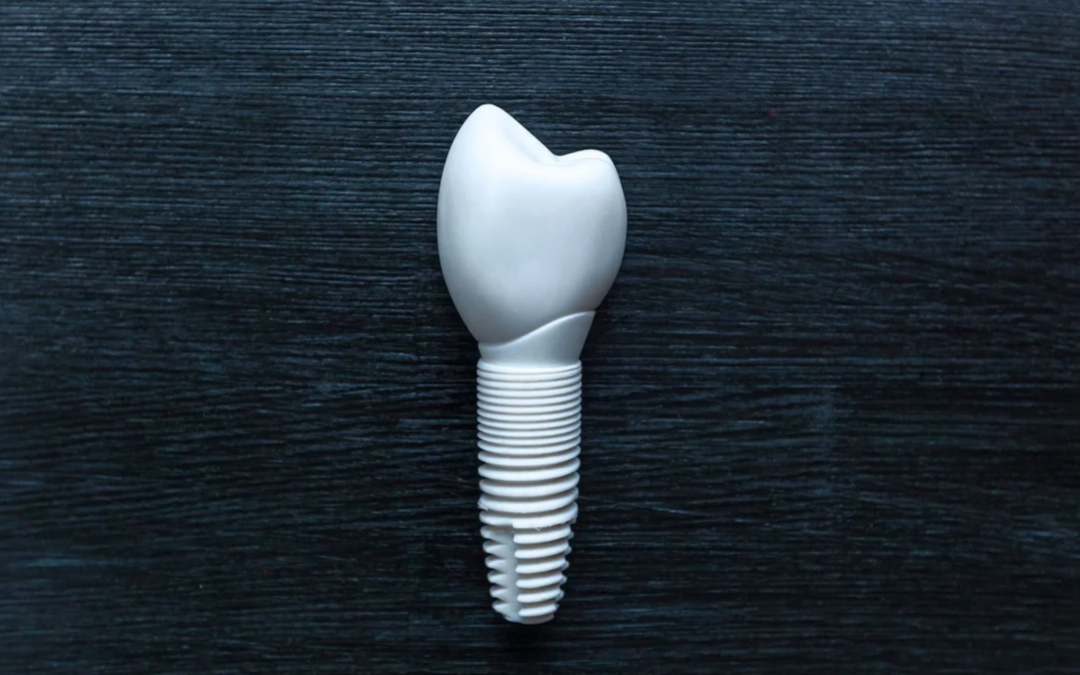 advantages of zirconia implants over traditional metal implants