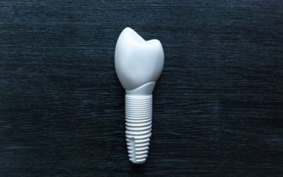 The Advantages of Zirconia Implants Over Traditional Metal Implants