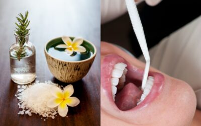 Holistic Dentistry vs. Traditional Dentistry: A Complete Comparison