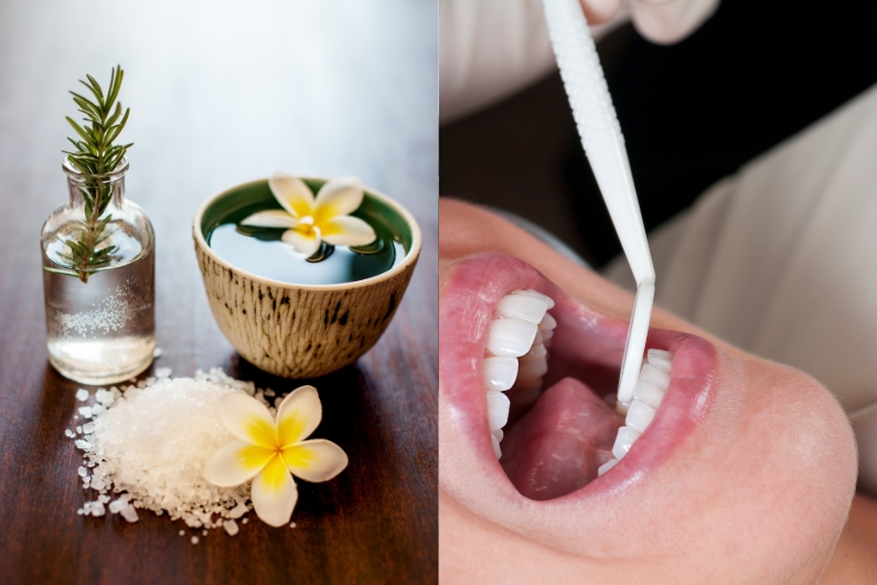 holistic dentistry vs. traditional dentistry a complete comparison